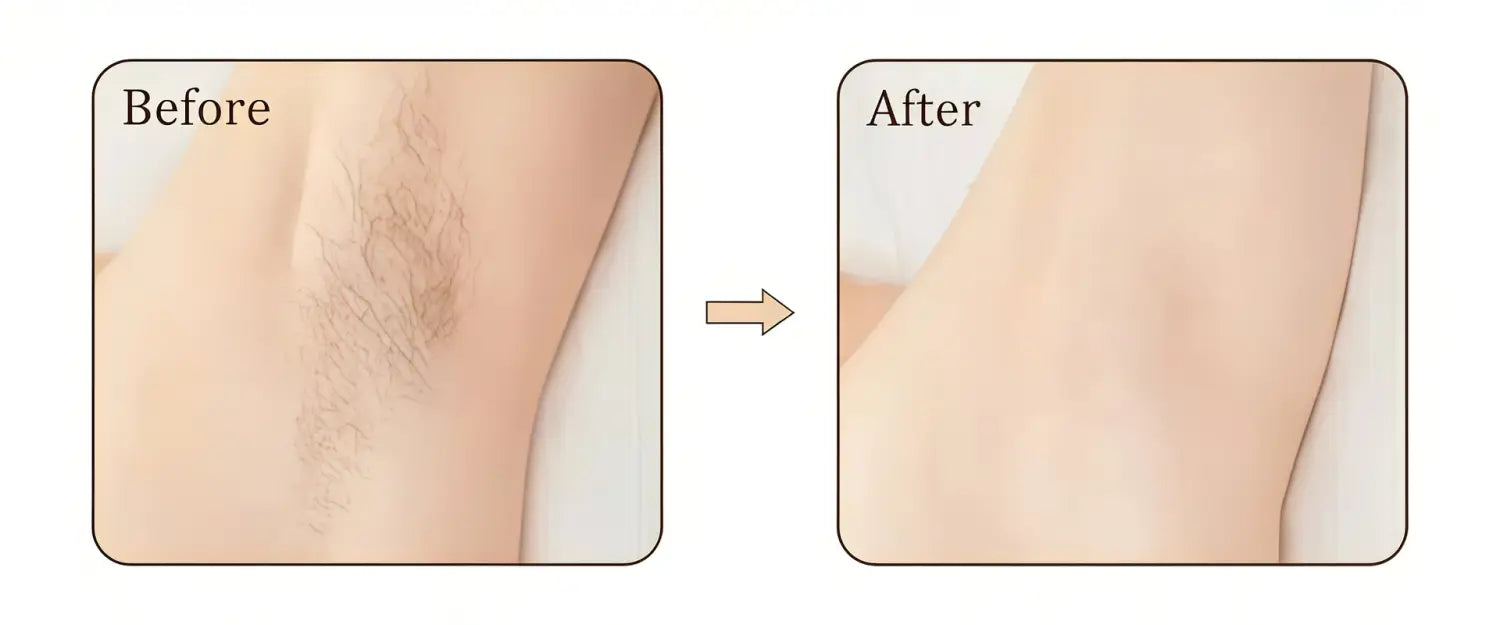 Dispositivo portatile per la depilazione a punto di congelamento testa sostituibile IPL a impulsi forti portatile