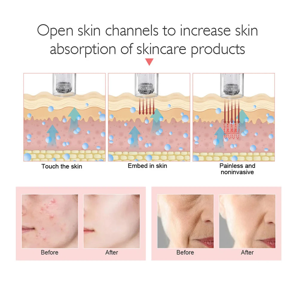 Macchina professionale per penna a microaghi con cartuccia Penna a microaghi wireless per Derma MTS Pen Macchina