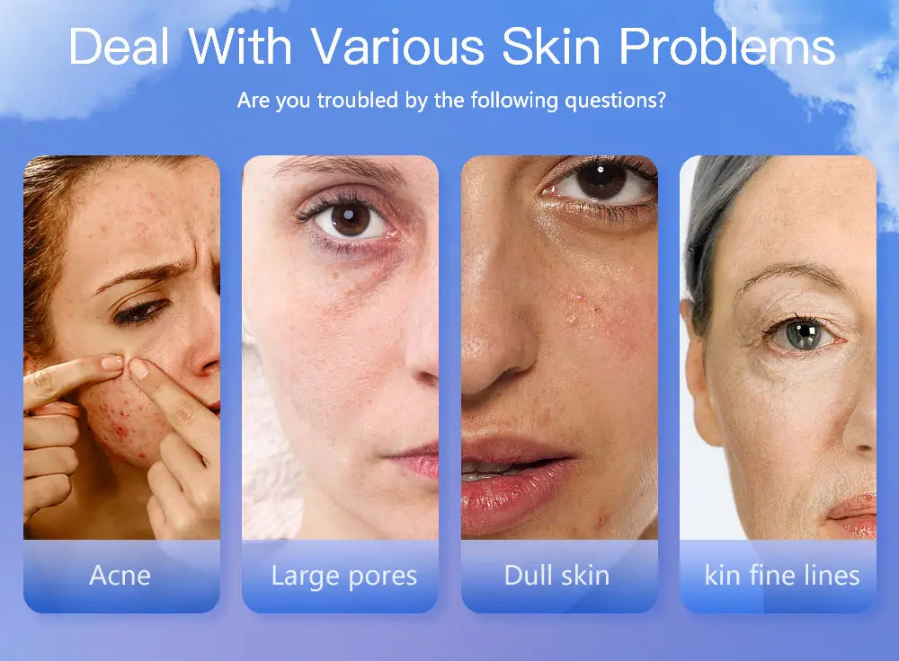 Test di idratazione cutanea USB analizzatore digitale per il rilevamento degli oli per la pelle inclusa penna