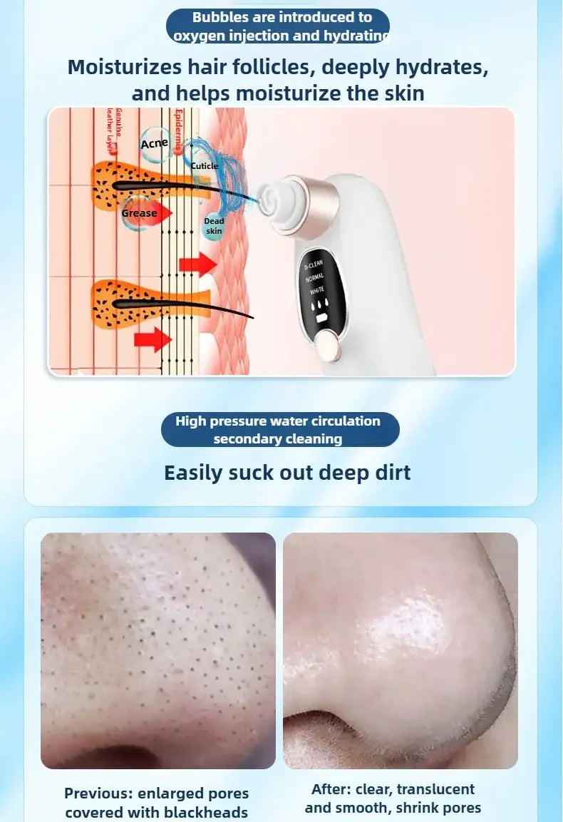 Rimuove punti neri Aspirapolvere per pori Elettrico Brufoli Acne Rimozione Punti Neri Rimozione Acqua ricaricabile USB
