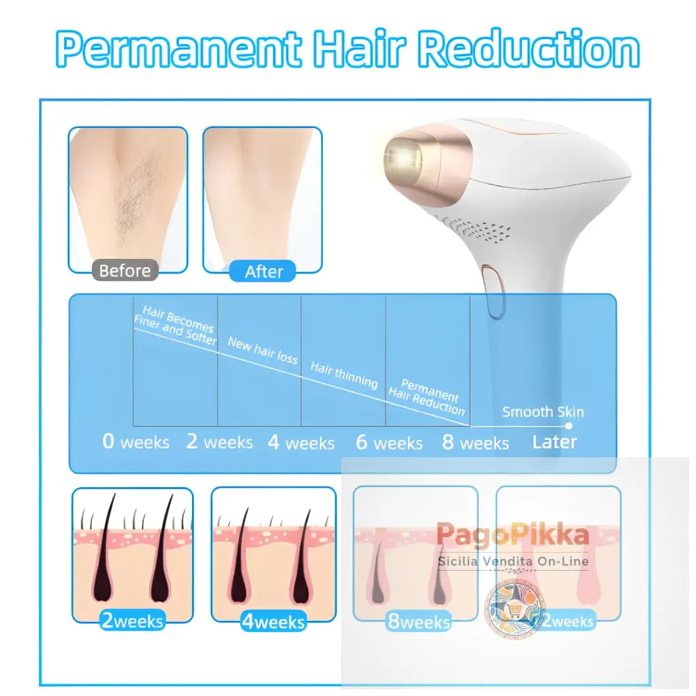 Dispositivo portatile per la depilazione a punto di congelamento testa sostituibile IPL a impulsi forti portatile