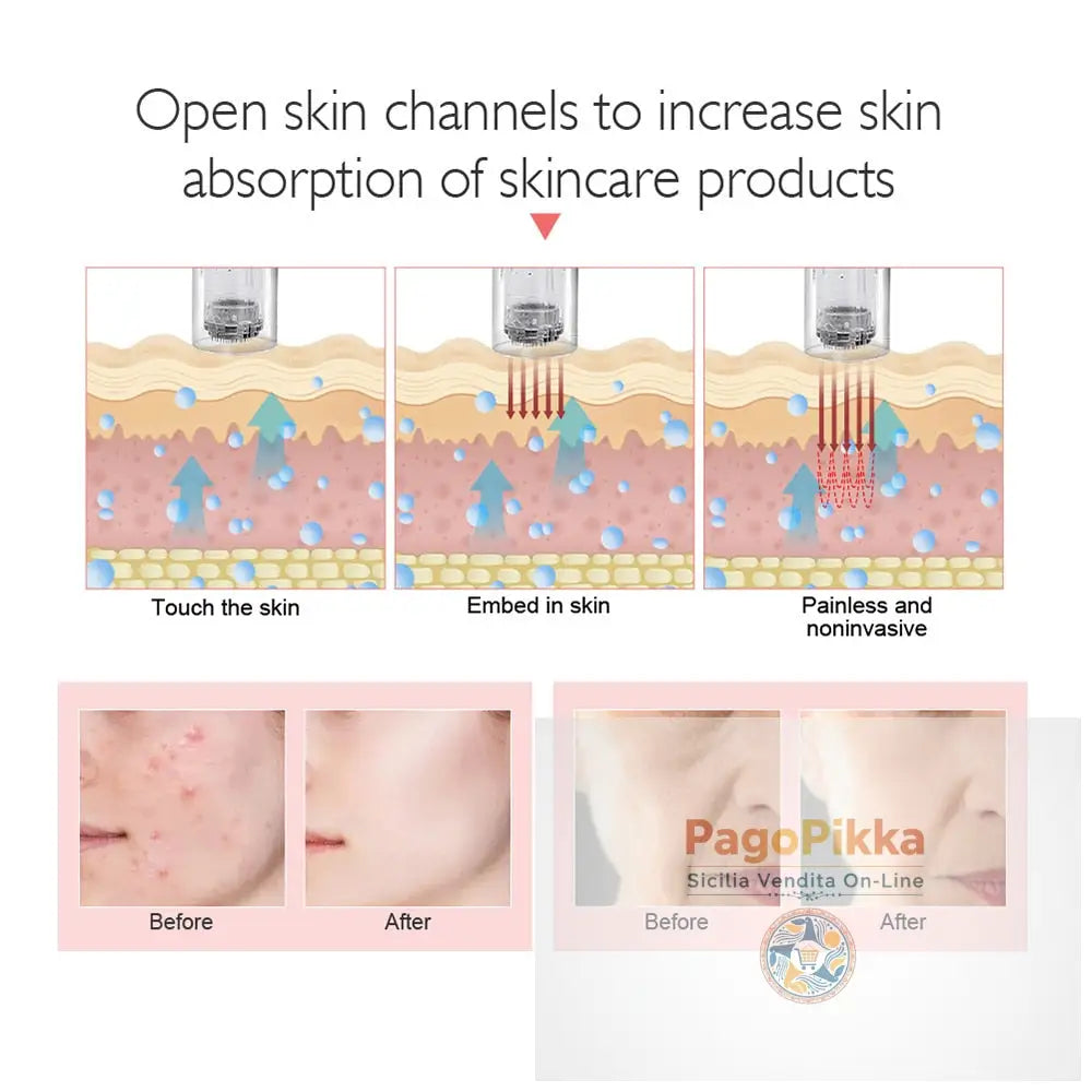 Macchina professionale per penna a microaghi con cartuccia Penna a microaghi wireless per Derma MTS Pen Macchina