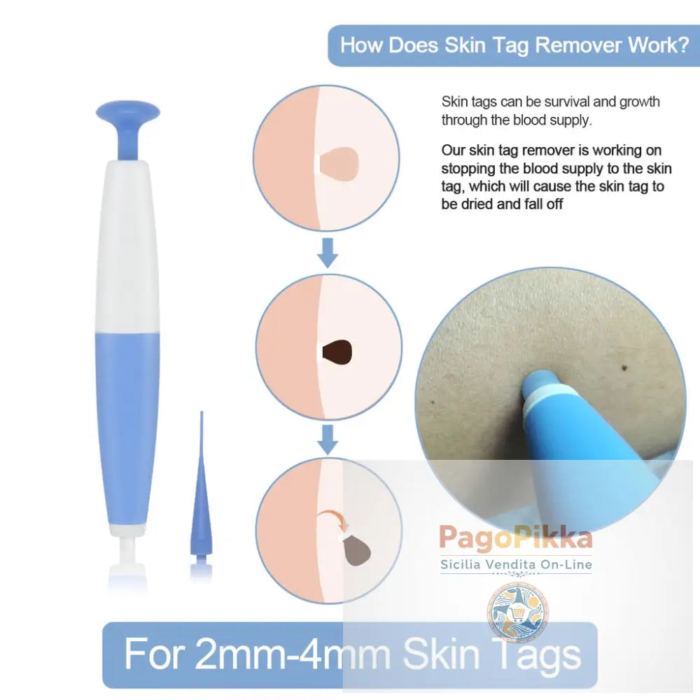 Rimozione di etichette cutanee Rimozione dell’acne Rimozione delle verruche Rimozione di etichette cutanee Rimozione