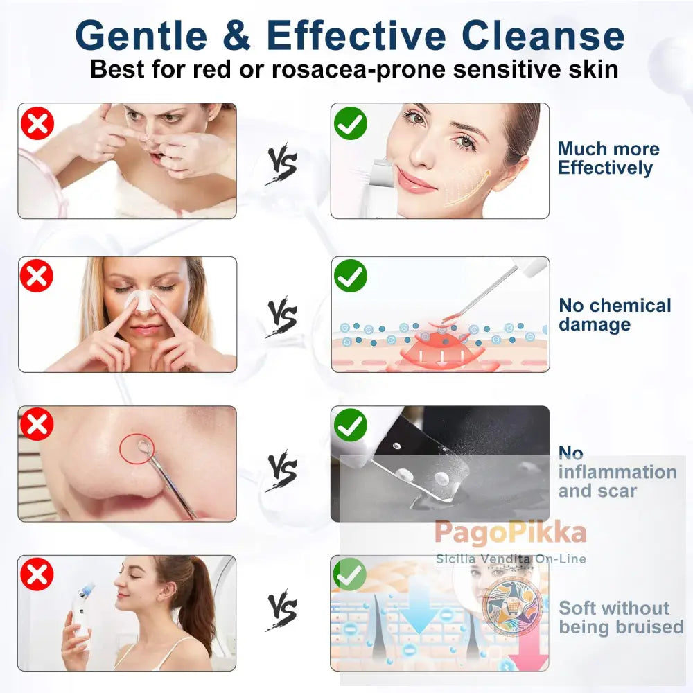 Schermo LCD Pulisce i pori Rimuove Punti Neri e Brufoli Spray Spray e Sporco Macchina per la Peeling Faccia - White